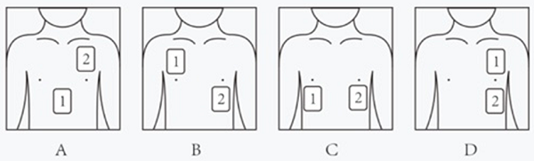 2024年深圳市考公务员录用考试《行测》试题(网友回忆版)(图1) 2024年深圳市考公务员录用考试《行测》试题(网友回忆版)(图1)
